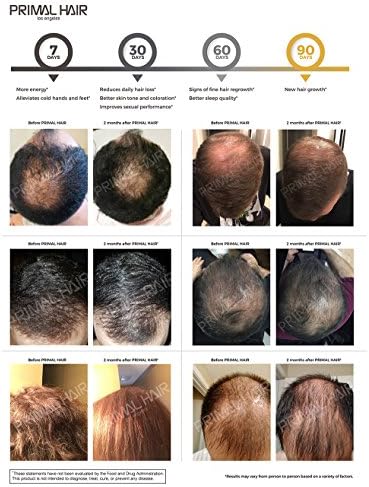 PRİMAL SAÇ: Saç Büyümesi ve Saç Dökülmesi Tedavisi, Saç İnceltme Takviyesi, Erkekler ve Kadınlar için Klinik olarak Kanıtlanmış